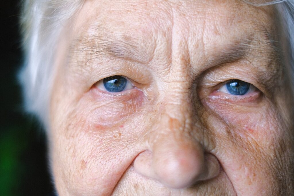 senior woman eyes